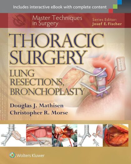Master Techniques in Surgery Thoracic Surgery Lung Resections, Bronchoplasty