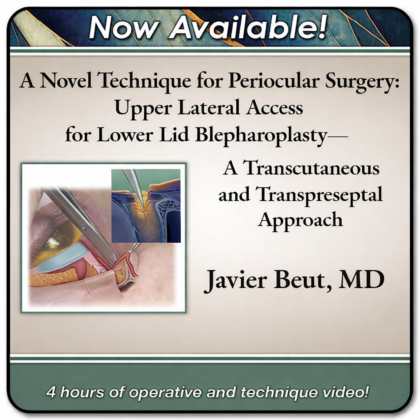 Upper Lateral Access for Lower Lid Blepharoplasty: A Novel Transcutaneous, Transpreseptal Periocular Technique
