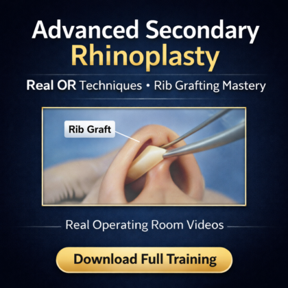 Secondary Open Rhinoplasty With Rib Grafting | Live Surgery Course